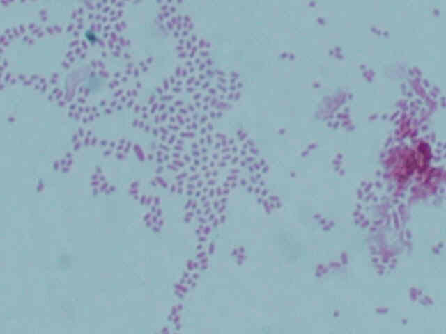 Type 1 endospore stain