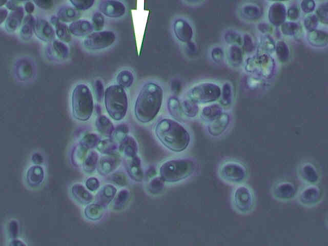 Yeast we isolated